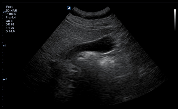 Abdomen slide image01