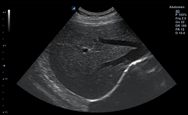 Abdomen slide image02