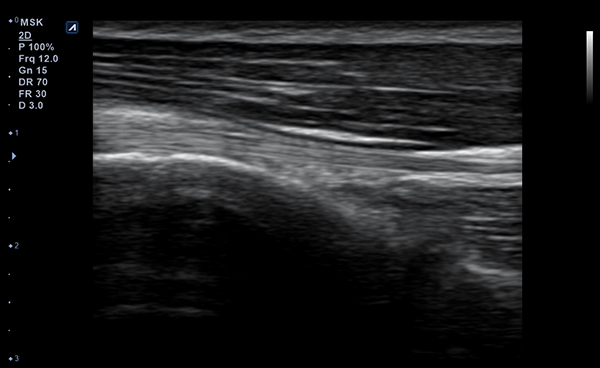 MSK Parts slide image01