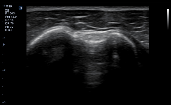 MSK Parts slide image02