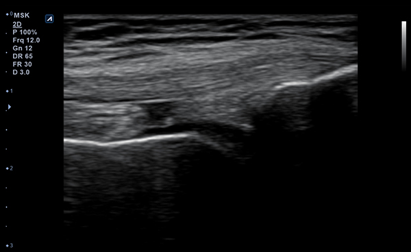 MSK Parts slide image03