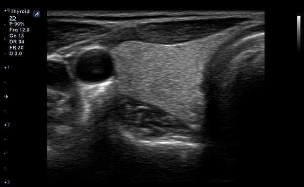 Small Parts slide image02