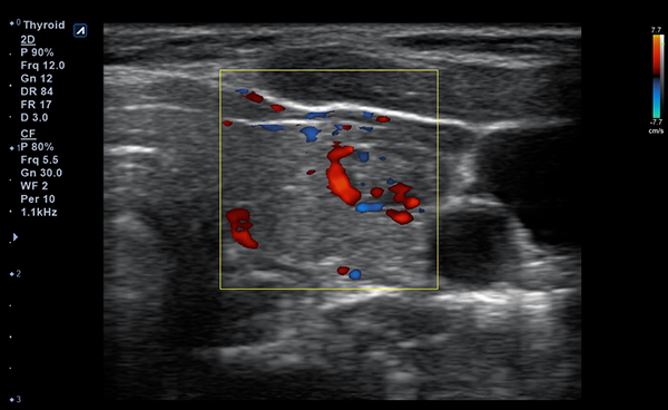 Small Parts slide image03