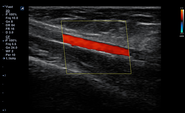 Vascular slide image01