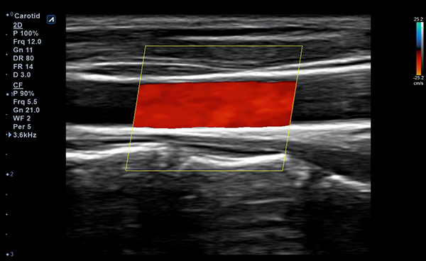 Vascular slide image03