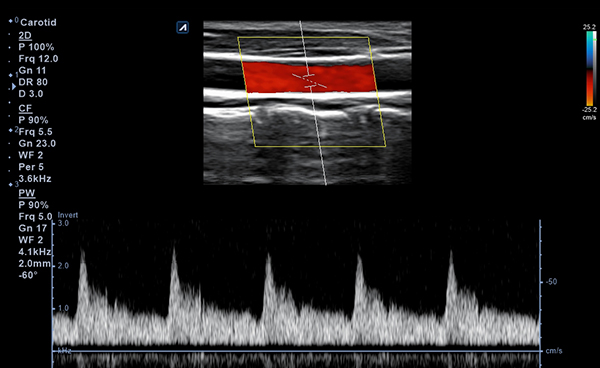 Vascular slide image04