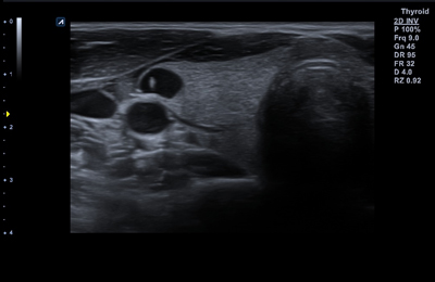 Optimal Imaging Suite™ Plus