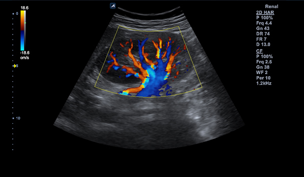 Transducers powered by PowerView™