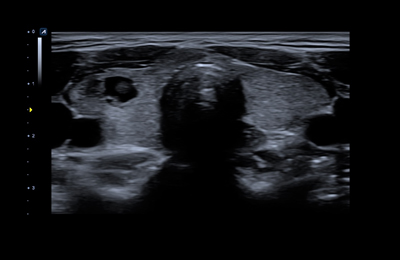 Optimal Imaging Suite™ Plus