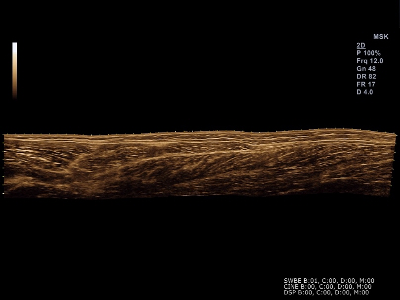 Muskuloskeletal image with Panoramic Imaging