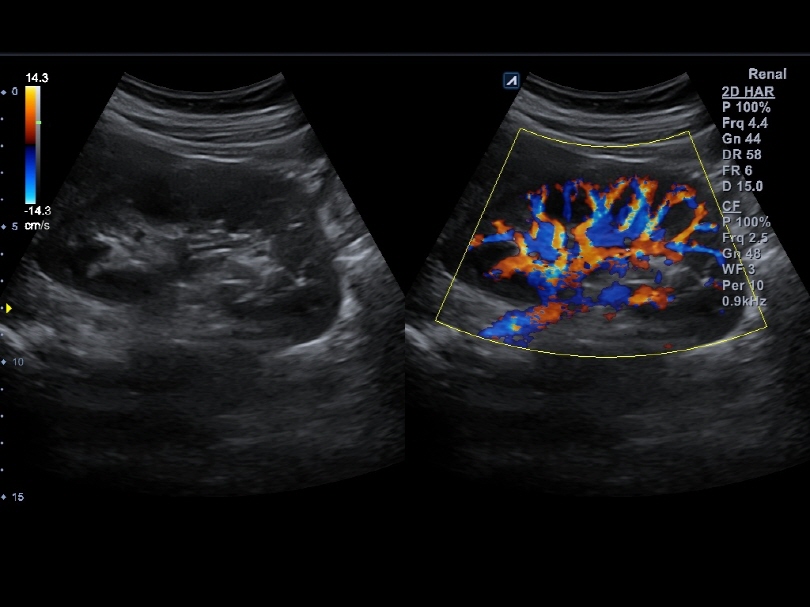 Kidney in Live Dual Mode1
