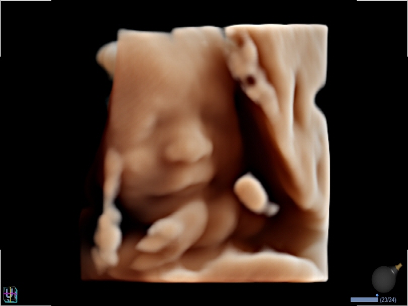 Fetal Face in Live HQ™(2)1