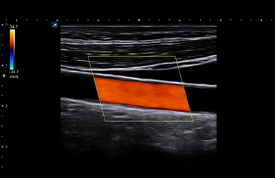 Frame rate increasing technology