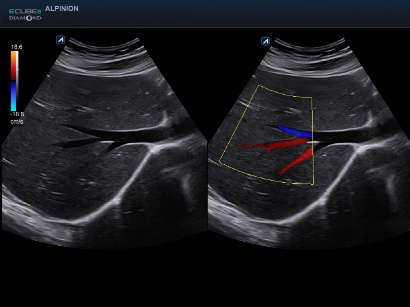 Abdomen in Dual mode