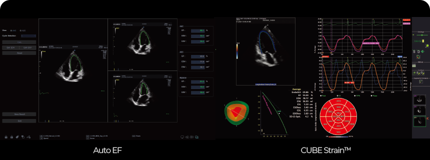 Echo Package : Auto EF, CUBE Strain™