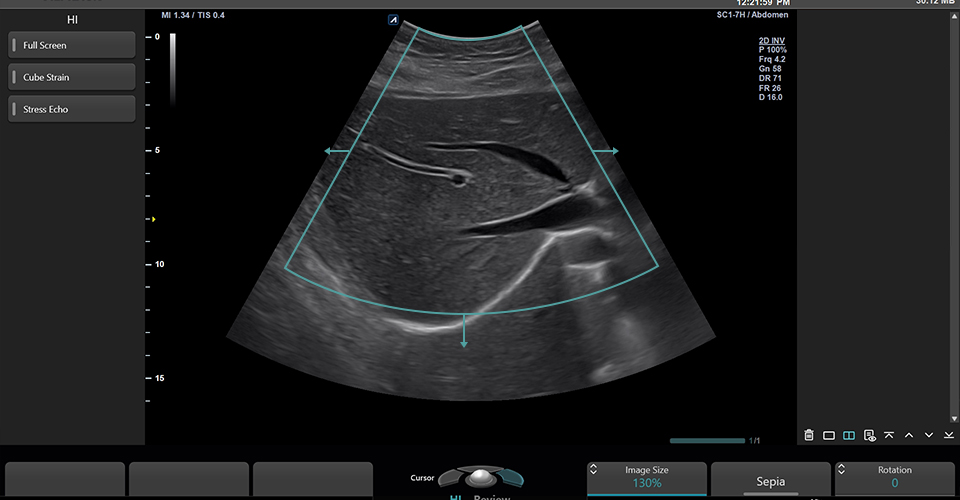 Tamaño de imagen ajustable