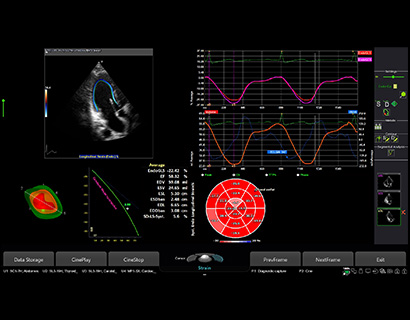 Auto-analysis package