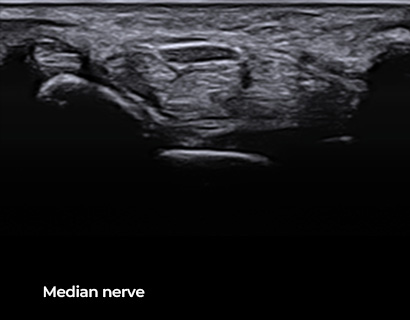 Imagen de alta calidad