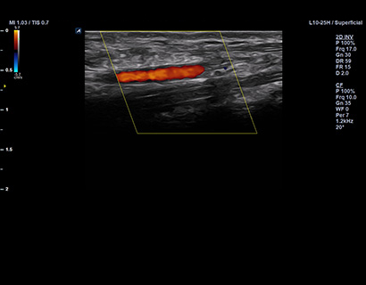 High freq. Transducers